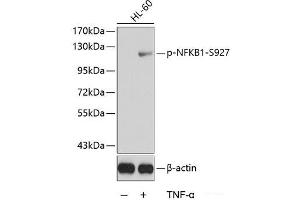 Western blot analysis of extracts from HL60 cells using Phospho-NFKB1(S927) Polyclonal Antibody.