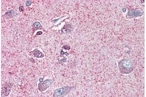 Brain, cortex, Human: Formalin-Fixed, Paraffin-Embedded (FFPE) (NTSR2 anticorps  (Internal Region))