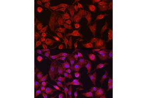 Immunofluorescence analysis of A-549 cells using R Rabbit pAb (ABIN6132924, ABIN6146720, ABIN6146721 and ABIN6214772) at dilution of 1:100 (40x lens). (RASGRP1 anticorps  (AA 598-797))