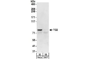 Western Blotting (WB) image for anti-Transglutaminase 2 (C Polypeptide, Protein-Glutamine-gamma-Glutamyltransferase) (TGM2) (AA 625-675) antibody (ABIN7450815)
