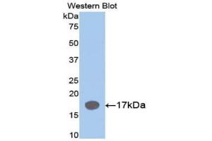Western blot analysis of the recombinant protein. (IL1RN anticorps  (AA 27-178))