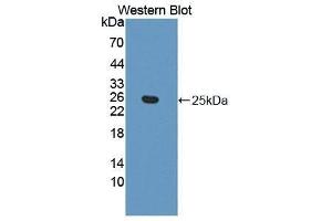 Western Blotting (WB) image for anti-Ephrin A5 (EFNA5) (AA 21-203) antibody (ABIN3204157) (Ephrin A5 anticorps  (AA 21-203))