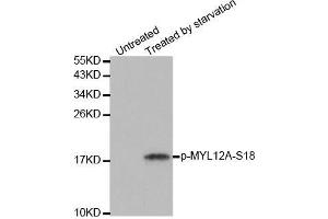 Western blot analysis of extracts from 293 cells untreated or treated with starvation using Phospho-MYL12A-S18 antibody.