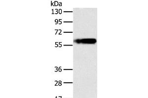 Western Blot analysis of Human fat tissue using PLIN1 Polyclonal Antibody at dilution of 1:200