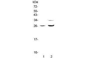 Western blot testing of rat 1) PC-12 and 2) RH35 lysate with Betacellulin antibody at 0. (Betacellulin anticorps)