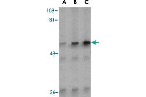 Western blot analysis of Irak2 in A-20 whole cell lysate with Irak2 polyclonal antibody  at (A) 0. (IRAK2 anticorps  (C-Term))