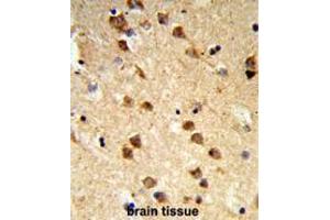 Formalin-fixed and paraffin-embedded human brain tissue reacted with ATXN3 Antibody (Center), which was peroxidase-conjugated to the secondary antibody, followed by DAB staining.
