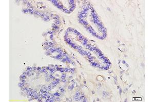 Formalin-fixed and paraffin embedded rabbit placenta labeled with Anti- PGT Polyclonal Antibody, Unconjugated at 1:200 followed by conjugation to the secondary antibody and DAB staining
