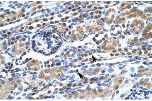 Human kidney; SUPT5H antibody - C-terminal region in Human kidney cells using Immunohistochemistry