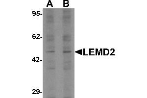 Western blot analysis of LEMD2 in 293 cell lysate with LEMD2 antibody at (A) 1 and (B) 2 µg/mL.