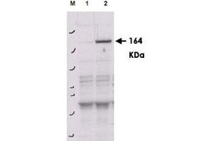 Western blot using ROCK2 (phospho Y256) polyclonal antibody  shows detection of phosphorylated ROCK2 in transfected 293T cells.