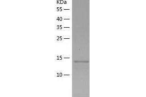 Western Blotting (WB) image for Endosulfine alpha (ENSA) (AA 2-121) protein (His-IF2DI Tag) (ABIN7122780)