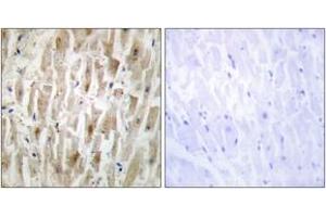 Immunohistochemistry (IHC) image for anti-LIM Domain Kinase 2 (LIMK2) (AA 461-510) antibody (ABIN2889517) (LIMK2 anticorps  (AA 461-510))