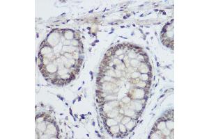 Immunohistochemistry of paraffin-embedded Human colon using PLZF antibody (ABIN6128472, ABIN6150368, ABIN6150369 and ABIN6221570) at dilution of 1:200 (40x lens).