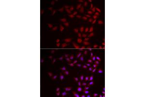 Immunofluorescence analysis of HeLa cells using CIRBP antibody (ABIN5973938). (CIRBP anticorps)