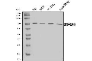 Western blot analysis of BLNK using anti-BLNK antibody (ABIN7602100).