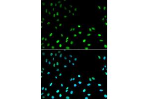 Immunofluorescence analysis of MCF-7 cells using RFC1 antibody. (RFC1 anticorps)