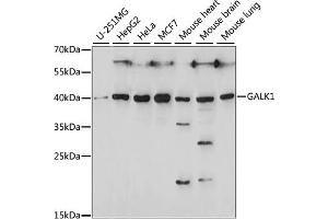 Western blot analysis of extracts of various cell lines, using G antibody (ABIN7267328) at 1:1000 dilution. (GALK1 anticorps  (AA 1-120))