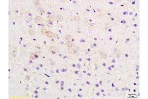 Formalin-fixed and paraffin embedded rat brain tissue labeled with Anti-ARHGAP32 Polyclonal Antibody, Unconjugated  at 1:200 followed by conjugation to the secondary antibody and DAB staining (ARHGAP32 anticorps  (AA 860-896))
