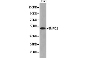 Western Blotting (WB) image for anti-Sphingomyelin phosphodiesterase 2, Neutral Membrane (Neutral Sphingomyelinase) (SMPD2) (AA 150-250) antibody (ABIN3021605) (SMPD2 anticorps  (AA 150-250))