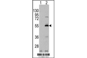 Western blot analysis of ALDH6A1 using rabbit polyclonal ALDH6A1 Antibody using 293 cell lysates (2 ug/lane) either nontransfected (Lane 1) or transiently transfected with the ALDH6A1 gene (Lane 2). (ALDH6A1 anticorps  (C-Term))
