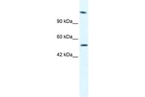 Western Blotting (WB) image for anti-DNA Helicase B (HELB) antibody (ABIN2461363) (DNA Helicase B anticorps)