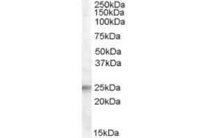 Image no. 1 for anti-Insulin-Like Growth Factor Binding Protein 6 (IGFBP6) (Internal Region) antibody (ABIN374965) (IGFBP6 anticorps  (Internal Region))