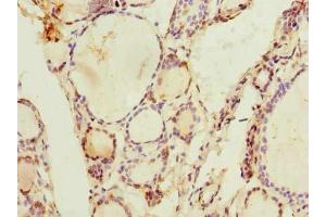 Immunohistochemistry of paraffin-embedded human thyroid tissue using ABIN7143477 at dilution of 1:100 (ARL11 anticorps  (AA 2-196))