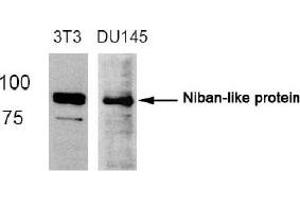 Image no. 2 for anti-Family with Sequence Similarity 129, Member B (FAM129B) (Ser712) antibody (ABIN319366) (MEG3 anticorps  (Ser712))