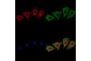 ABIN7094328 and ABIN7098375 staining HepG2 cells by IF/ICC.