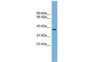 WB Suggested Anti-C14orf28 Antibody Titration: 0. (GM527 anticorps  (Middle Region))