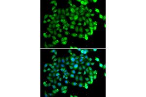 Immunofluorescence (IF) image for anti-Apolipoprotein B mRNA Editing Enzyme, Catalytic Polypeptide-Like 3C (APOBEC3C) antibody (ABIN1980244)