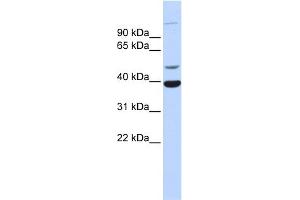 WB Suggested Anti-ZNF124 Antibody Titration:  0.