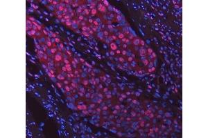 IF analysis of SNRPD2 using anti-SNRPD2 antibody (ABIN7598963). (SNRPD2 anticorps  (AA 1-118))