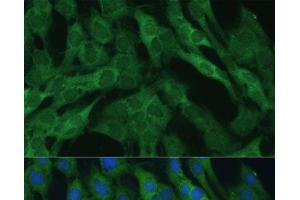 Immunofluorescence analysis of C6 cells using IDH1 Polyclonal Antibody at dilution of 1:100 (40x lens).