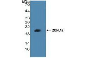 Detection of Recombinant PPARd, Human using Polyclonal Antibody to Peroxisome Proliferator Activated Receptor Delta (PPARd) (PPARD anticorps  (AA 260-426))