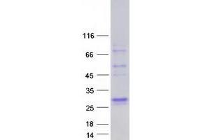 Validation with Western Blot