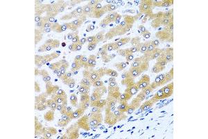 Immunohistochemistry of paraffin-embedded human liver using CCL21 antibody at dilution of 1:100 (40x lens).