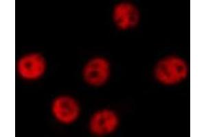 ABIN6277580 staining  HeLa cells by IF/ICC. (DP1 anticorps  (C-Term))