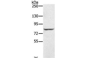 Western Blot analysis of Jurkat cell using RNF43 Polyclonal Antibody at dilution of 1:300 (RNF43 anticorps)