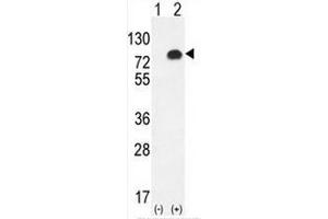 Western blot analysis of GPC6 (arrow) using rabbit polyclonal GPC6 Antibody (C-term) . (Glypican 6 anticorps  (C-Term))