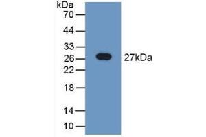 Detection of Recombinant TUBd, Rat using Polyclonal Antibody to Tubulin Delta (TUBd) (TUBD1 anticorps  (AA 238-482))