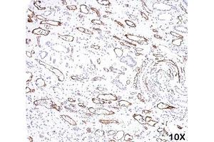 IHC testing of FFPE human kidney transplant tissue (10X) stained with C4d antibody (C4D204). (Complement C4d anticorps)