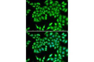 Immunofluorescence analysis of U2OS cells using MCM3 antibody (ABIN5970419). (MCM3 anticorps)