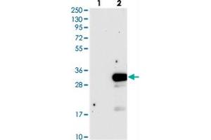 Western blot analysis of Lane 1: Negative control (vector only transfected HEK293T lysate), Lane 2: Over-expression Lysate (Co-expressed with a C-terminal myc-DDK tag (~3. (DTD1 anticorps)