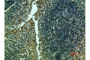 anti-Telomerase Reverse Transcriptase (TERT) (AA 1268-1341) antibody