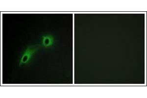 anti-CaM Kinase-Like Vesicle-Associated (CAMKV) antibody