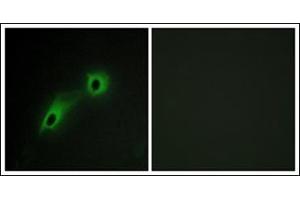 Immunofluorescence analysis of HeLa cells, using CAMK5 Antibody. (CAMKV anticorps)