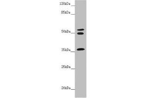Western blot All lanes: RNF41 antibody at 5. (RNF41 anticorps  (AA 1-317))