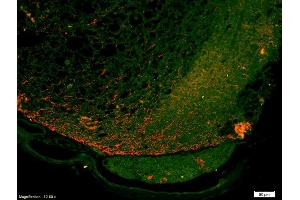 Formalin-fixed and paraffin-embedded injured rat spinal cord labeled with Anti-FPRL1 Polyclonal Antibody, Unconjugated (ABIN702175) 1:200, overnight at 4°C, The secondary antibody was Goat Anti-Rabbit IgG, Alexa Fluor 647 conjugated used at 1:200 dilution for 40 minutes at 37°C. (FPR2 anticorps  (AA 51-150))